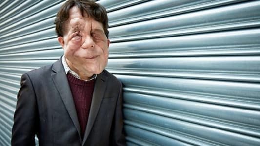 Image The Ugly Face of Disability Hate Crime