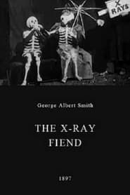 The X-Ray Fiend series tv