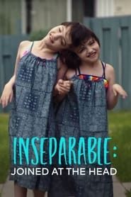Inseparable: Ten Years Joined at the Head series tv