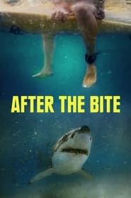 After the Bite series tv