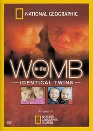 Image In the Womb Identical Twins