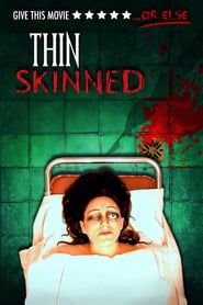 Thin Skinned series tv