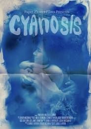 Cyanosis ()