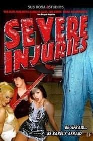Severe Injuries series tv