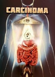 Carcinoma-hd