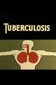 Image Tuberculosis