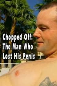 Chopped Off: The Man Who Lost His Penis series tv