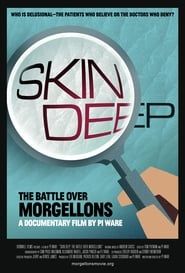Image Skin Deep: The Battle Over Morgellons