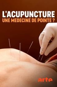 Spitzenmedizin: Akupunktur - Mythos oder Therapie? series tv