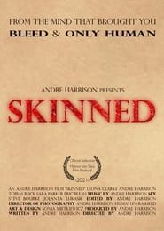 Skinned series tv