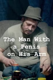 The Man With a Penis on His Arm series tv