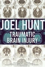 Joel Hunt: Traumatic Brain Injury (TBI)-hd