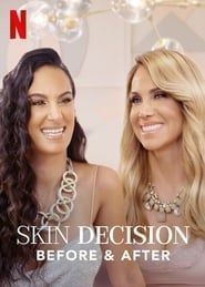 Skin Decision: Before and After series tv