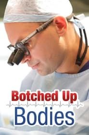 Botched Up Bodies series tv